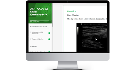 ACP POCUS 11: Lower Extremity MSK